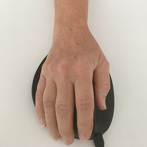 handtherapie2